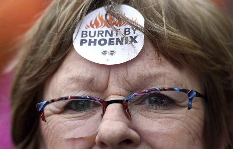 A woman wears a sticker on her forward that says "burnt by phoenix"